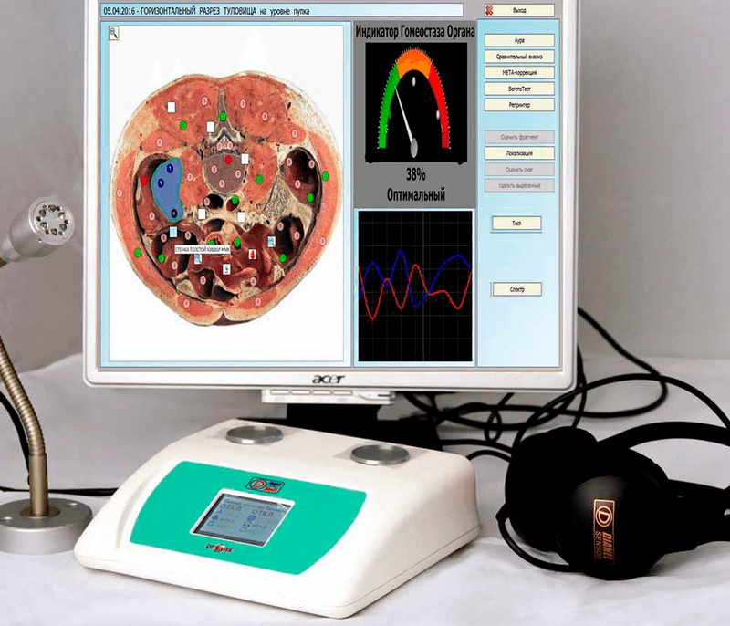 Bioresonance Therapy Houston - Benefits of Bioresonance Therapy