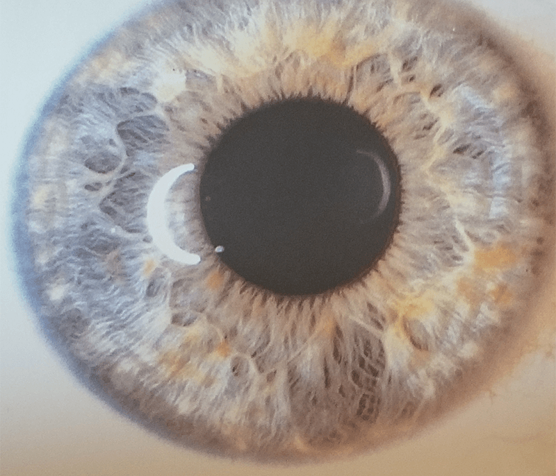 Holistic Iridology Houston - Benefits of Holistic Iridology